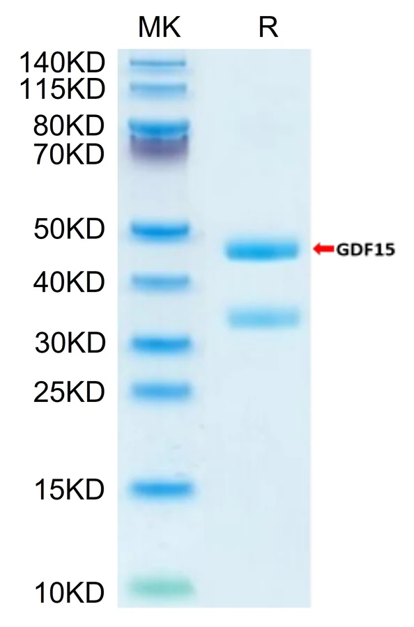 GDF15-MB001 Bis-Tris-PAGE result
