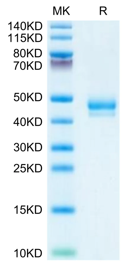 GIP-HF001 Bis-Tris-PAGE-white result