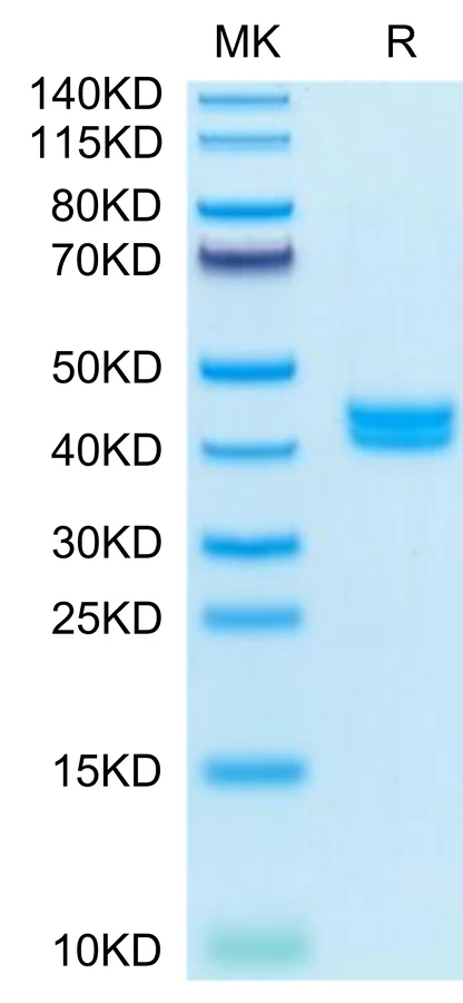 GIP-MF001 Bis-Tris-PAGE-white result