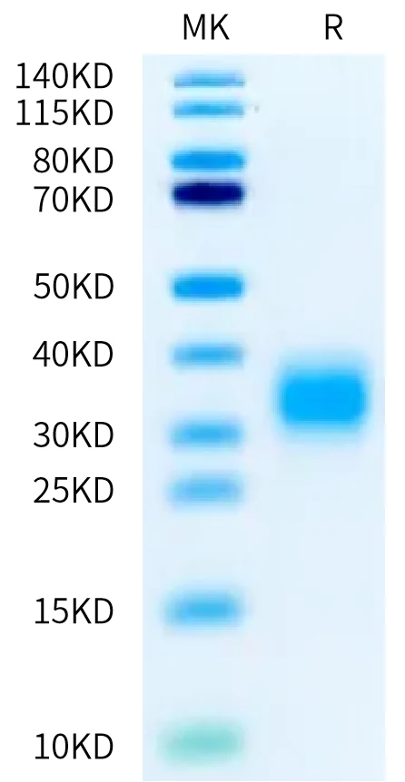 GIPR-CB001 Bis-Tris-PAGE-white result