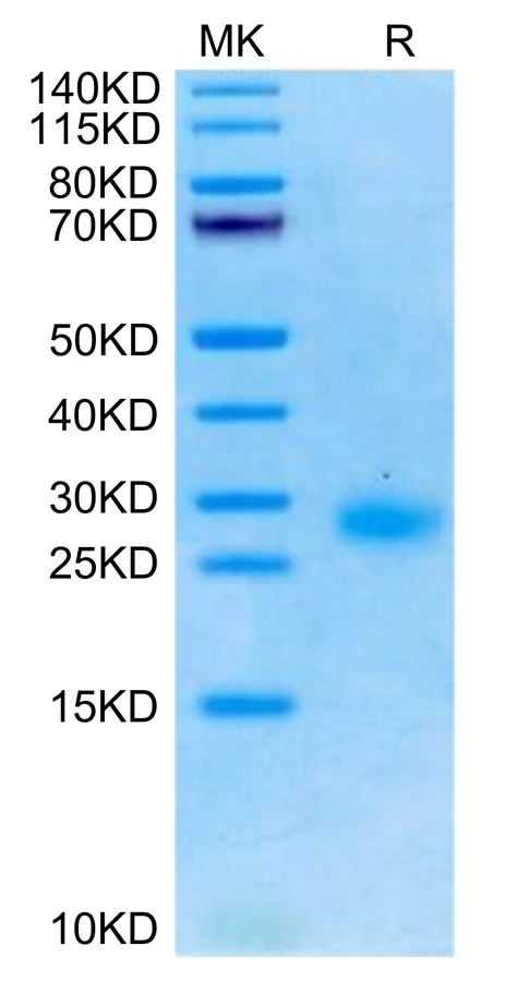 GITR-CP001 Bis-Tris-PAGE-white result
