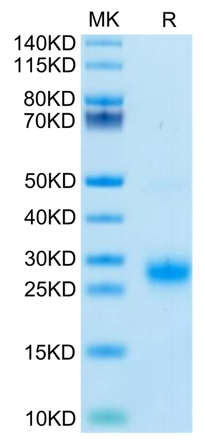 GITR-HB001 Bis-Tris-PAGE-white result