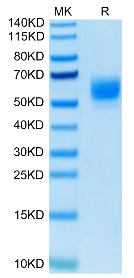 GITR-HB002 Bis-Tris-PAGE-white result