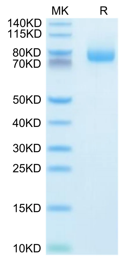 GITR-HF001 Bis-Tris-PAGE-white result