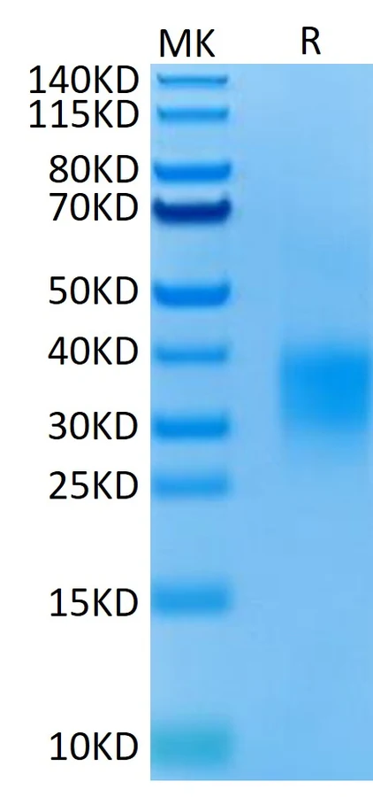 GITR-MP002 Bis-Tris-PAGE result