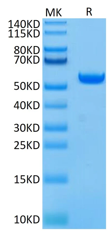 GP100-HB001 Bis-Tris-PAGE result