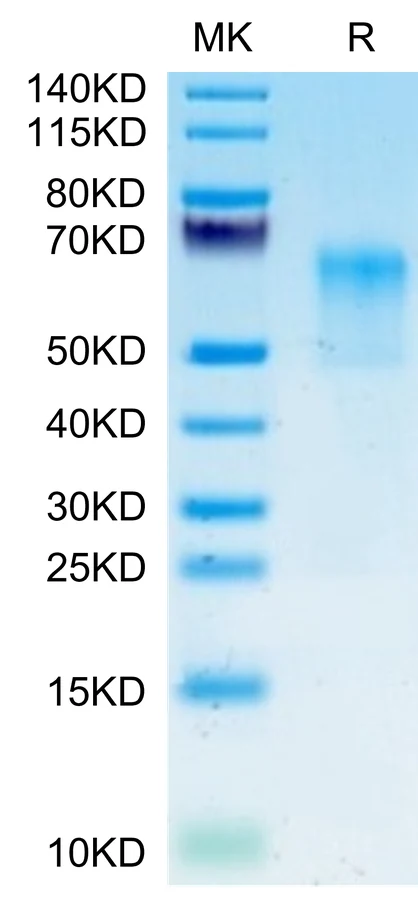 GPA-HF001 Bis-Tris-PAGE-white result