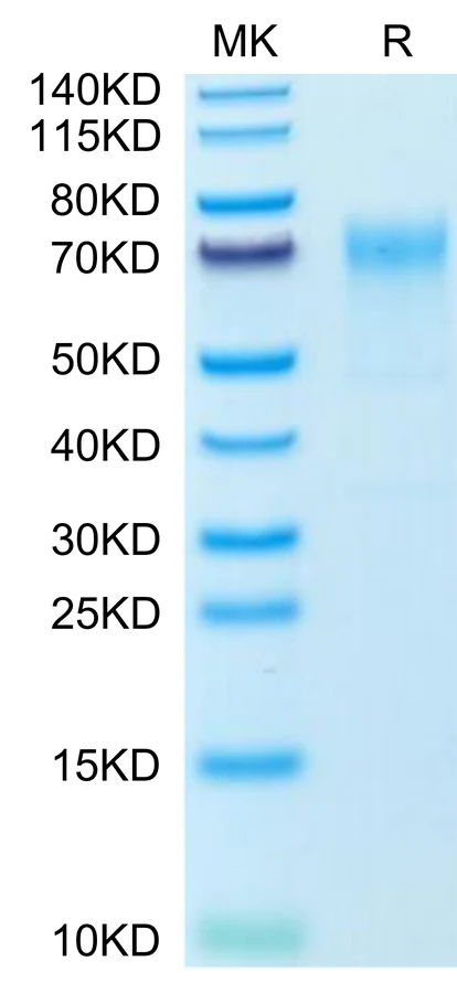 GPA-MF001 Bis-Tris-PAGE-white result