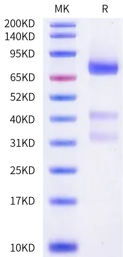 GPC3-HB001 Bis-Tris-PAGE-white result