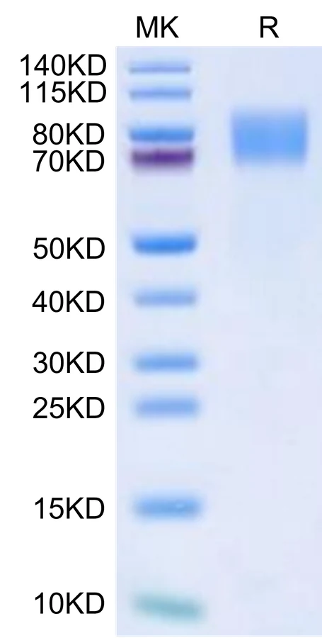 GUCY2C-MB001 Bis-Tris-PAGE-white result
