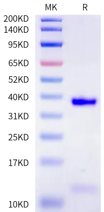 HBV-HB001 Bis-Tris-PAGE-white result