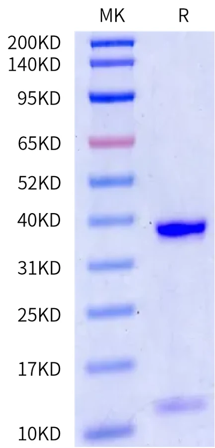 HBV-HB003 Bis-Tris-PAGE-white result