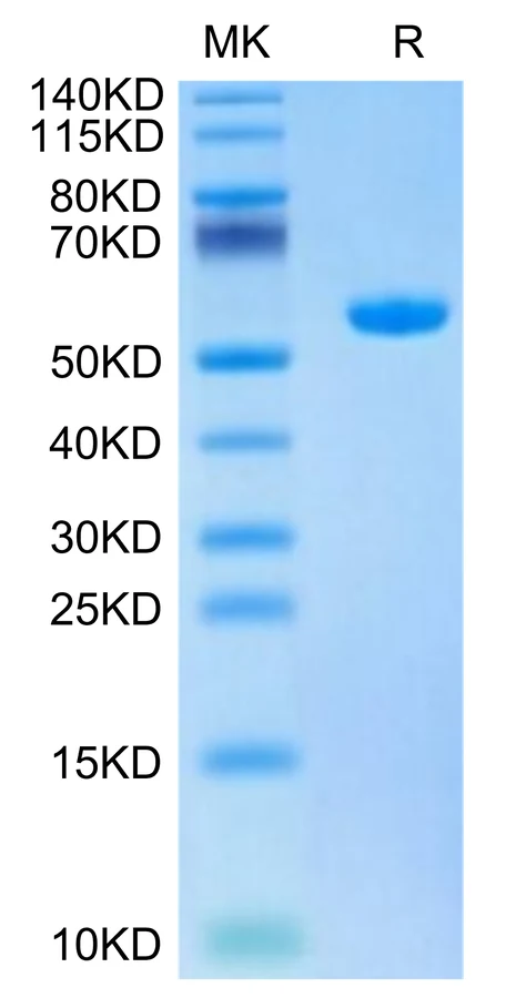 HBV-HB004 Bis-Tris-PAGE-white result