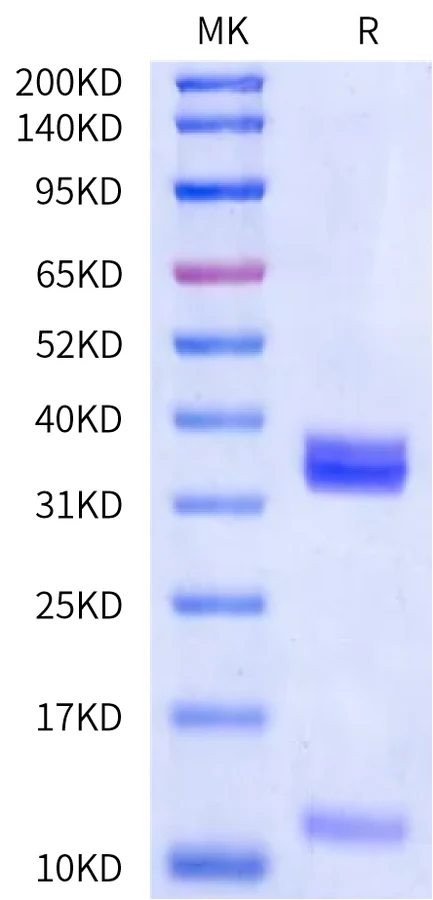 HBV-HP001 Bis-Tris-PAGE-white result