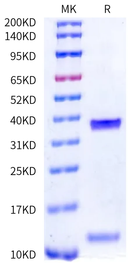 HBV-HP004 Bis-Tris-PAGE-white result
