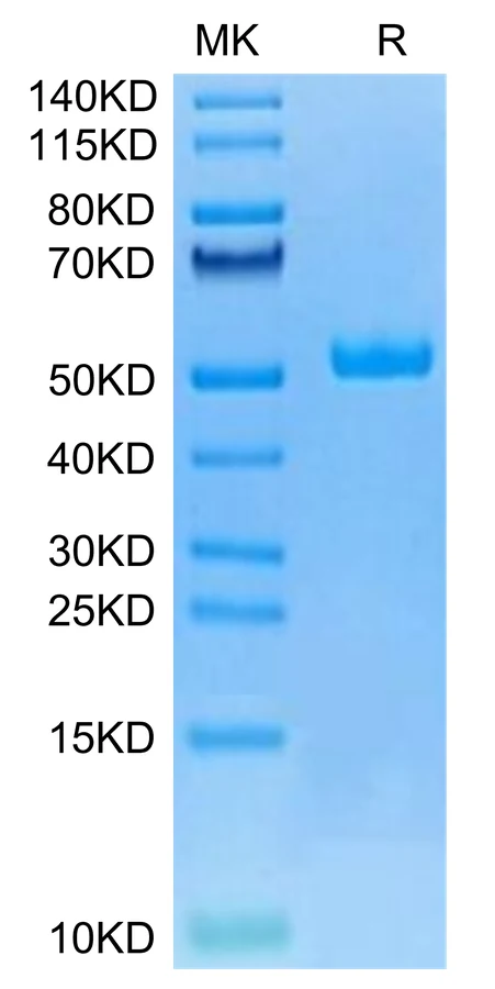 HE4-DF001 Bis-Tris-PAGE-white result