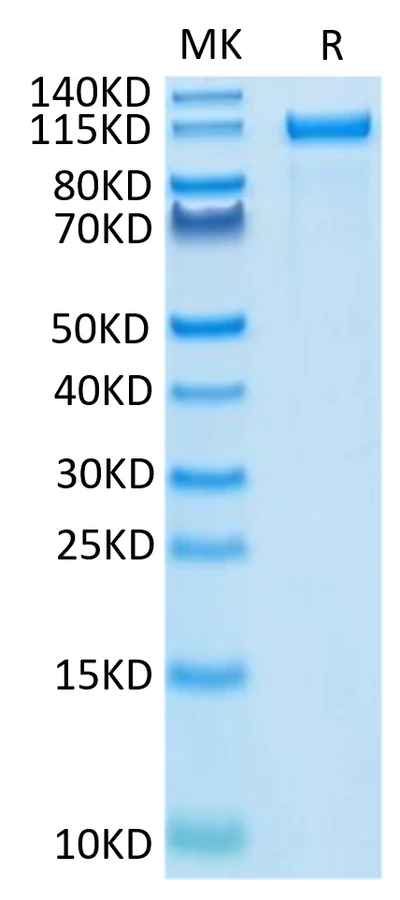 HER2-HF001 Bis-Tris-PAGE-white result