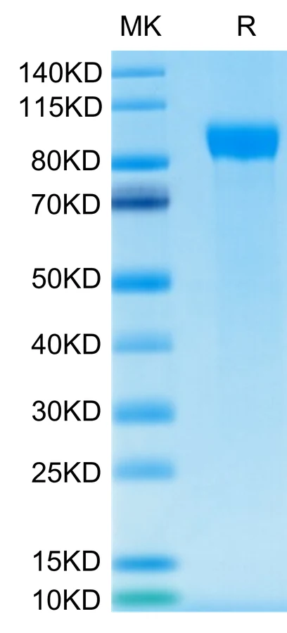 HER2-HP001 Bis-Tris-PAGE-white result