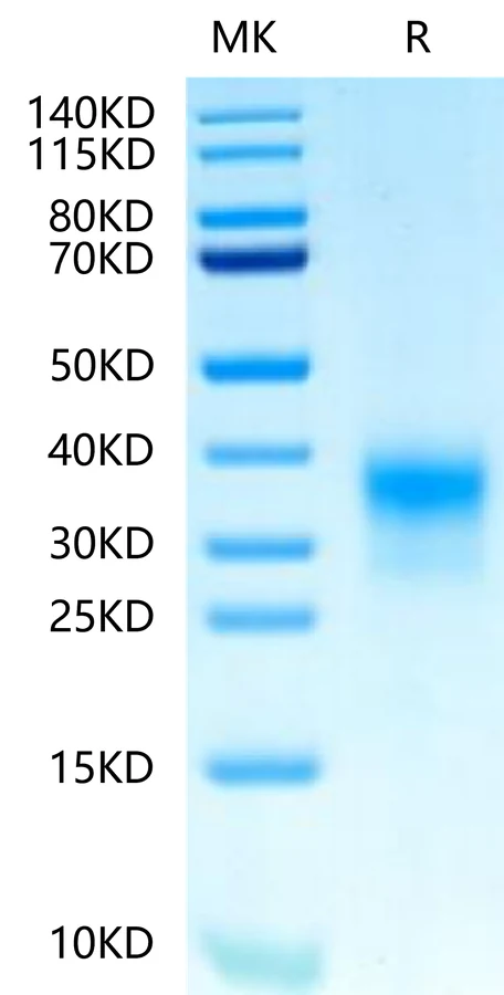 HER2ERBB2DOMAIN4-HB001 Bis-Tris-PAGE-white result