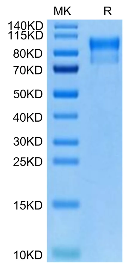 HER4ERBB4-HB001 Bis-Tris-PAGE-white result
