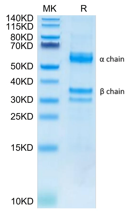 HGF-HP001 Bis-Tris-PAGE result