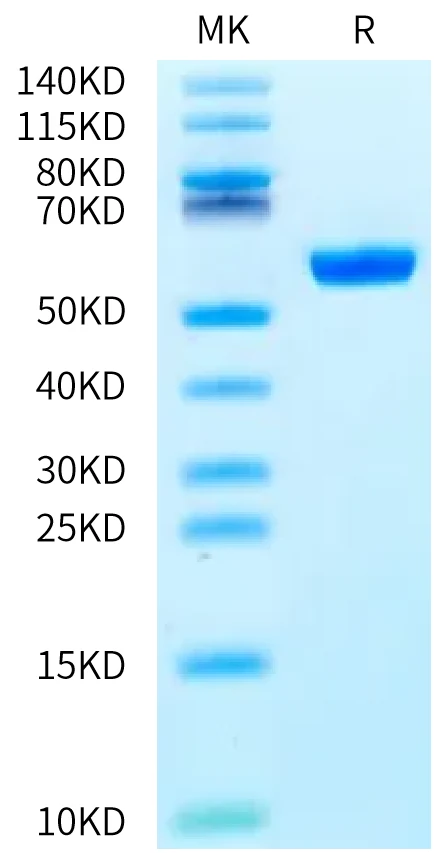 HIVGAG-HP001 Bis-Tris-PAGE-white result