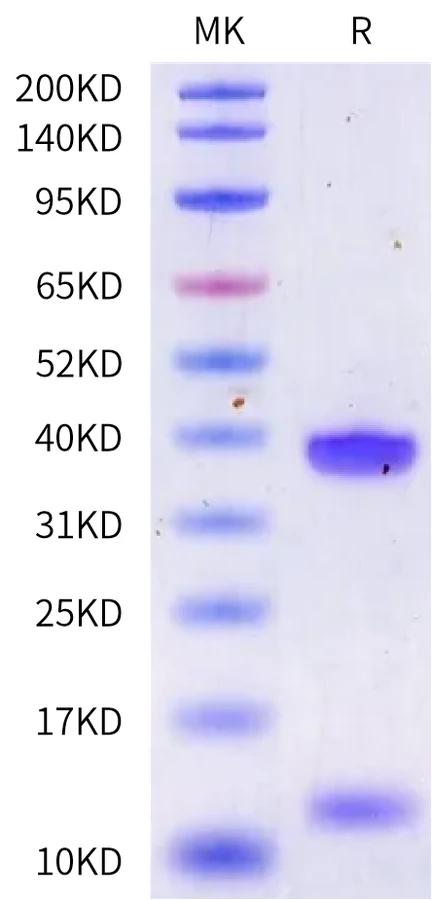 HLA-HB001 Bis-Tris-PAGE-white result