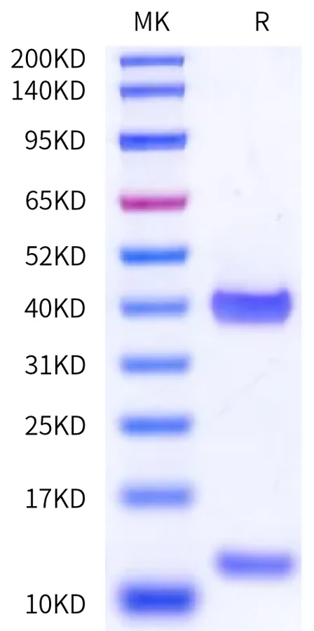 HLA-HB002 Bis-Tris-PAGE-white result