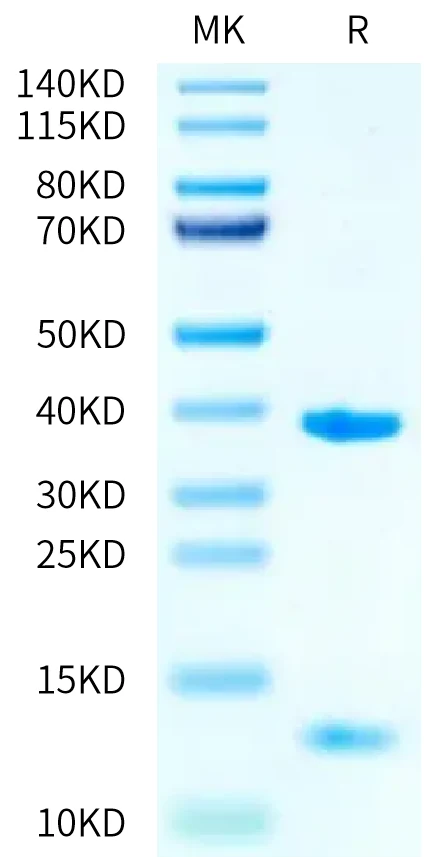 HLAA0201-HB001 Bis-Tris-PAGE-white result
