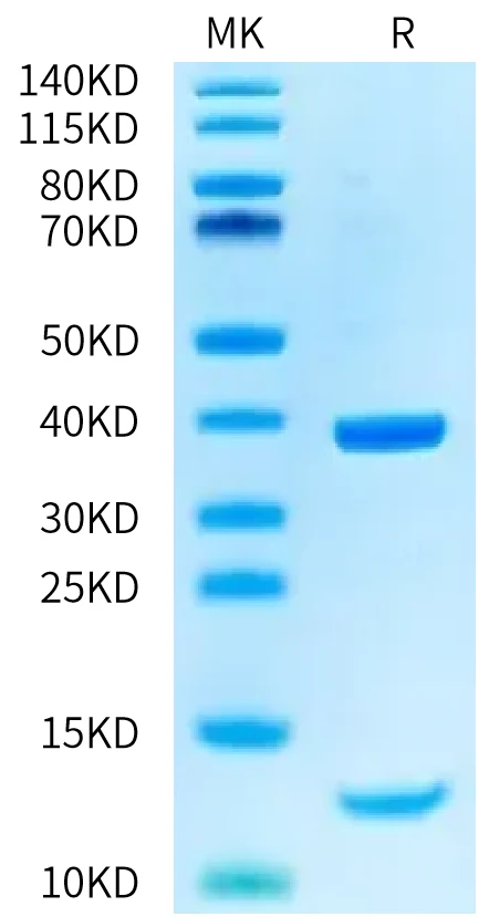 HLAA0201-HB002 Bis-Tris-PAGE-white result
