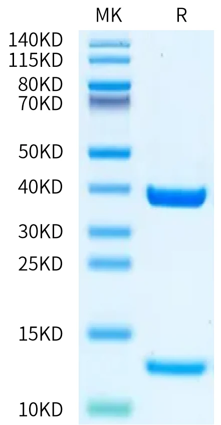 HLAA0201-HB006 Bis-Tris-PAGE-white result