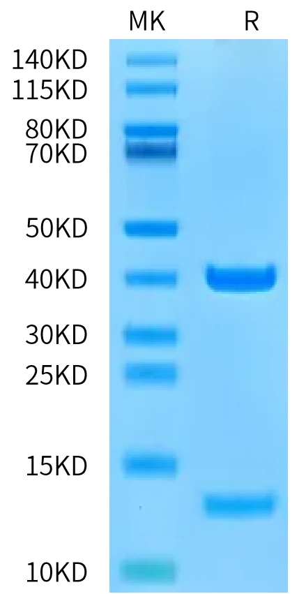 HLAA0201-HB008 Bis-Tris-PAGE-white result