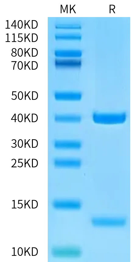 HLAA0201-HB009 Bis-Tris-PAGE-white result