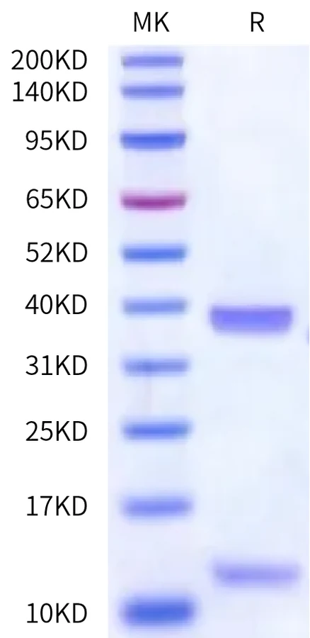 HLAA0201-HB011 Bis-Tris-PAGE-white result