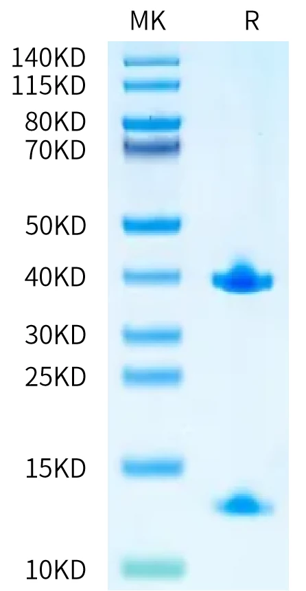 HLAA0201-HP001 Bis-Tris-PAGE-white result