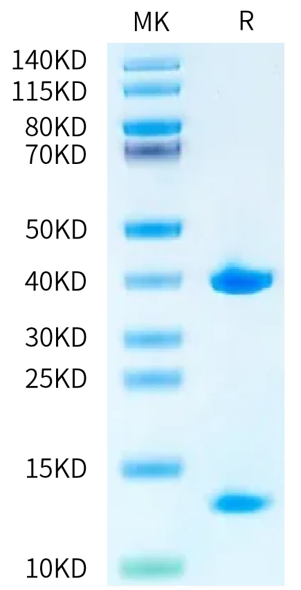 HLAA0201-HP002 Bis-Tris-PAGE-white result