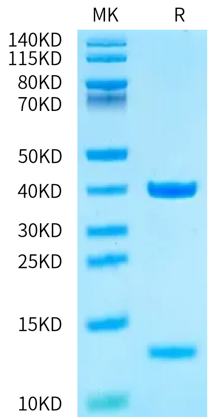 HLAA0201-HP003 Bis-Tris-PAGE-white result