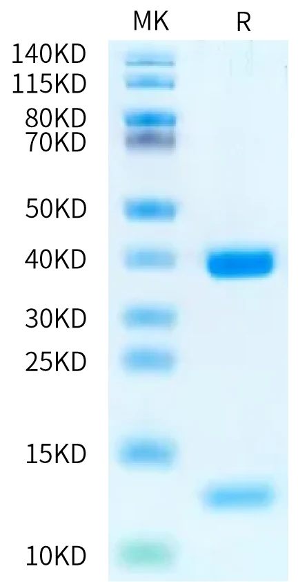 HLAA0201-HP004 Bis-Tris-PAGE-white result