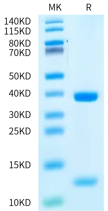 HLAA0201-HP005 Bis-Tris-PAGE-white result
