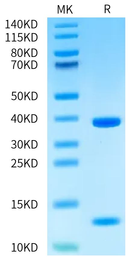 HLAA0201-HP006 Bis-Tris-PAGE-white result