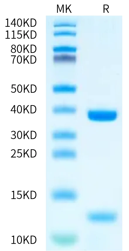 HLAA0201-HP007 Bis-Tris-PAGE-white result