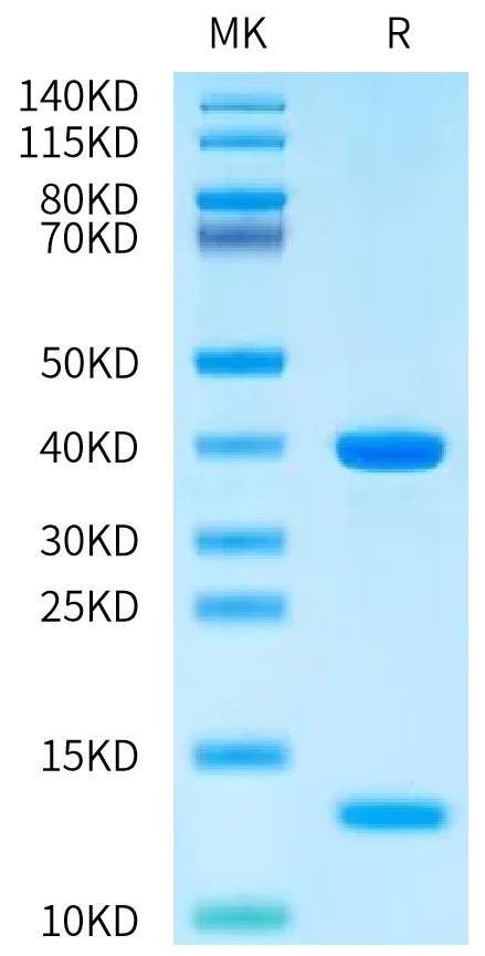 HLAA0201-HP008 Bis-Tris-PAGE-white result