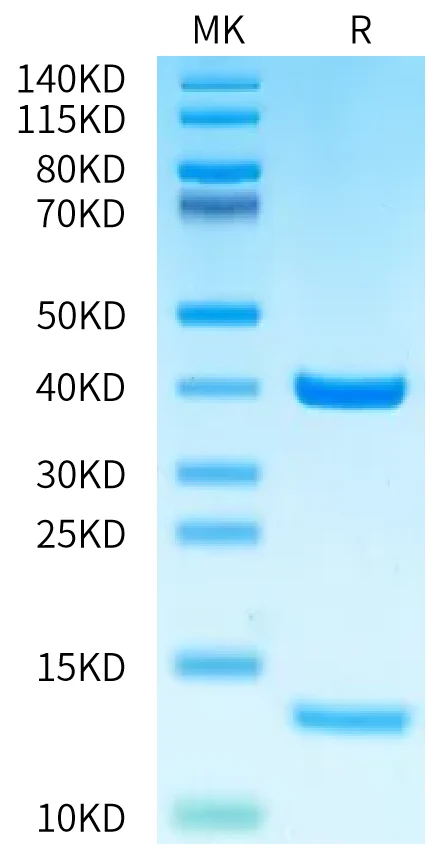 HLAA0201-HP009 Bis-Tris-PAGE-white result