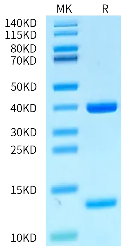 HLAA0201-HP010 Bis-Tris-PAGE-white result