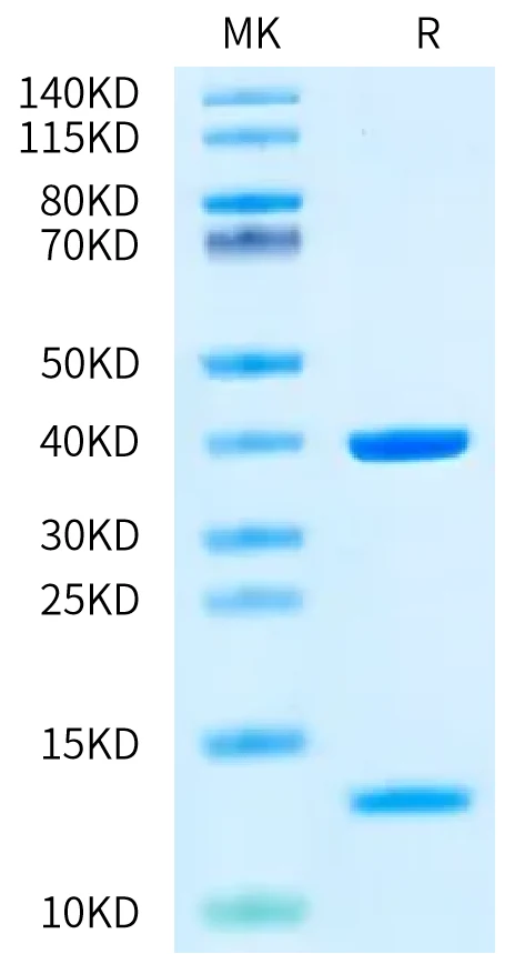 HLAA0201-HP011 Bis-Tris-PAGE-white result