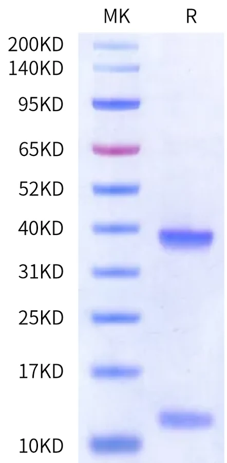 HLAA0201-HP013 Bis-Tris-PAGE-white result