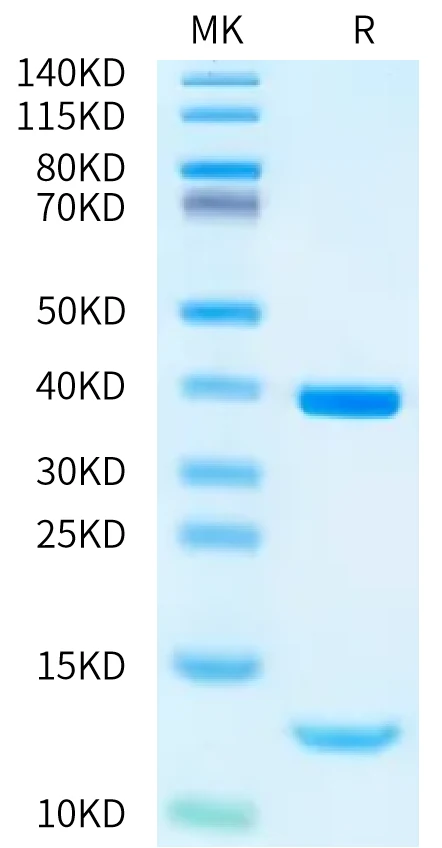 HLAA0301-HB001 Bis-Tris-PAGE-white result