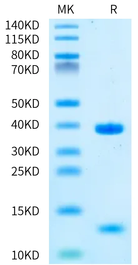HLAA0301-HP001 Bis-Tris-PAGE-white result