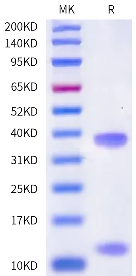 HLAA0301-HP002 Bis-Tris-PAGE-white result