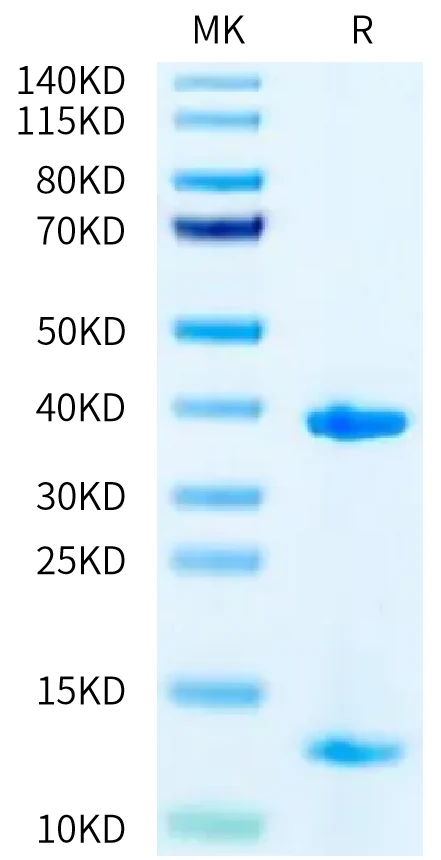 HLAA1101-HB001 Bis-Tris-PAGE-white result